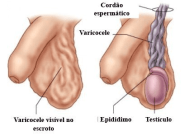 Microcirurgia com doppler